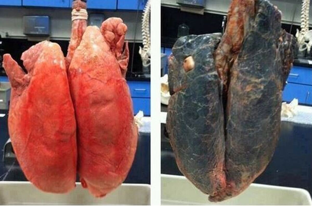تاثیر و ضرر سیگار روی بدن