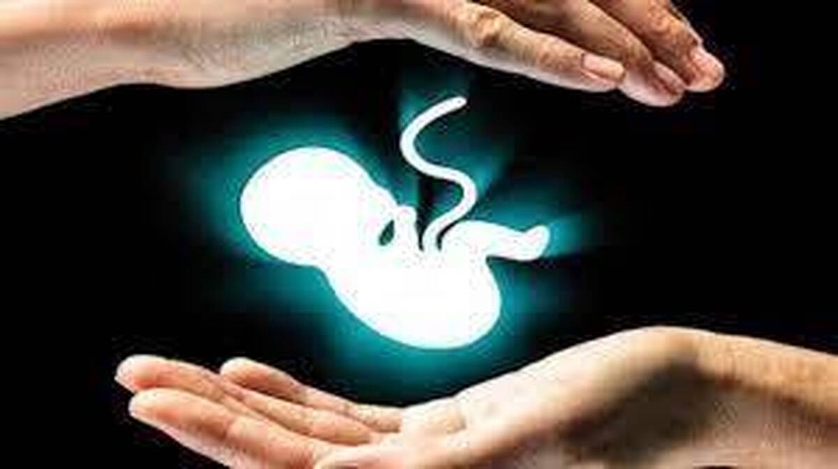 هر سال بیش از ۳۷۰ هزار سقط جنین در ایران رخ می‌دهد