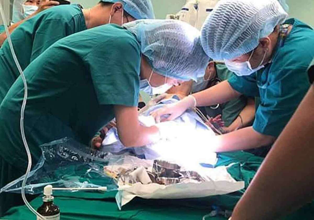موفقیت مرحله اولیه جراحی دوقلوهای به هم چسبیده