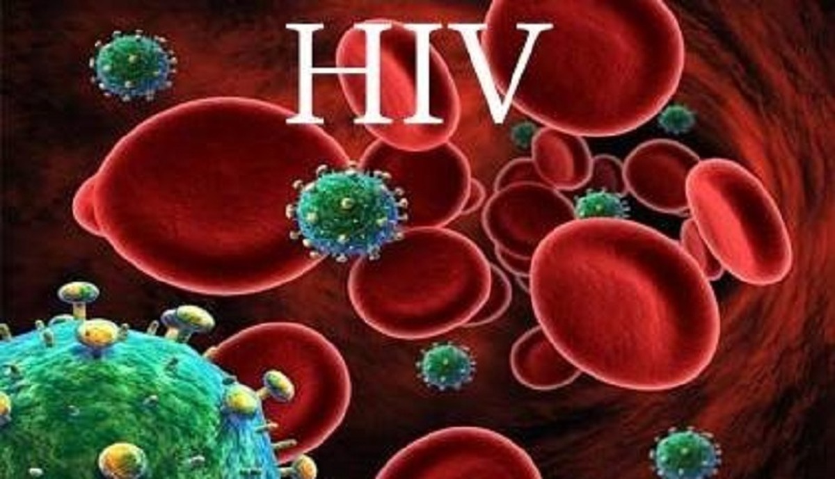 درمان رایگان و محرمانه HIV در کشور