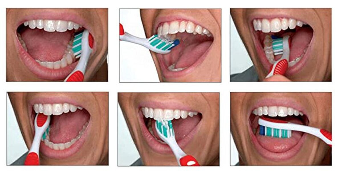 روش صحیح تمیز کردن دندانها با مسواک