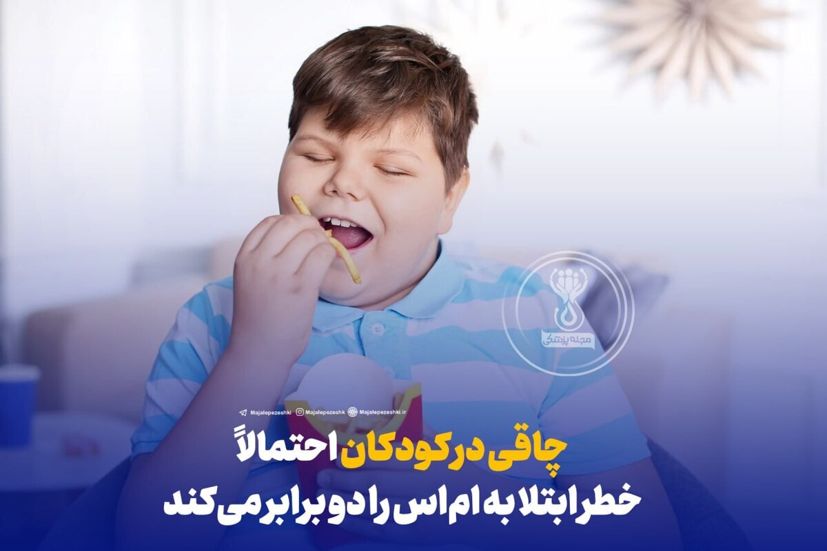 محققان سوئدی: چاقی در کودکان احتمالاً خطر ابتلا به ام‌اس را دو برابر می‌کند!