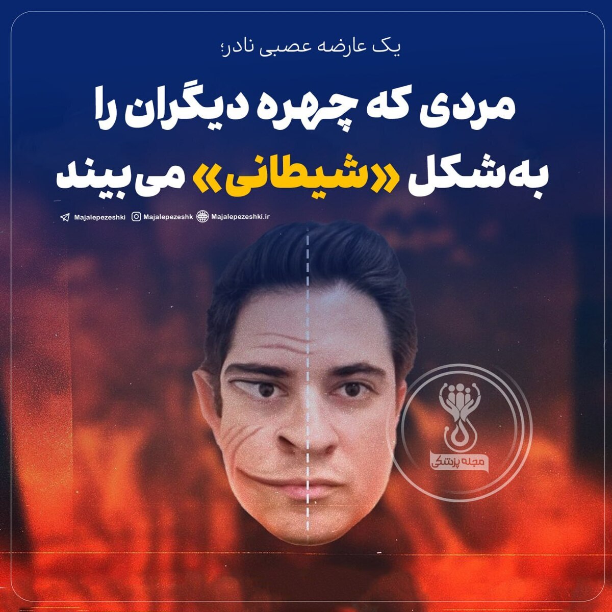 مردی که چهره دیگران را به‌شکل «شیطانی» می‌بیند!