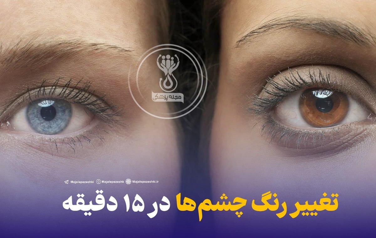 تغییر رنگ چشم‌ها در ۱۵ دقیقه!