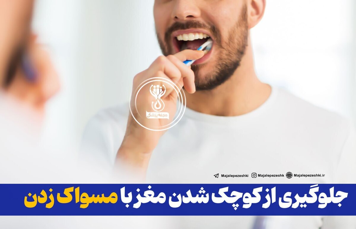 جلوگیری از کوچک شدن مغز با مسواک زدن