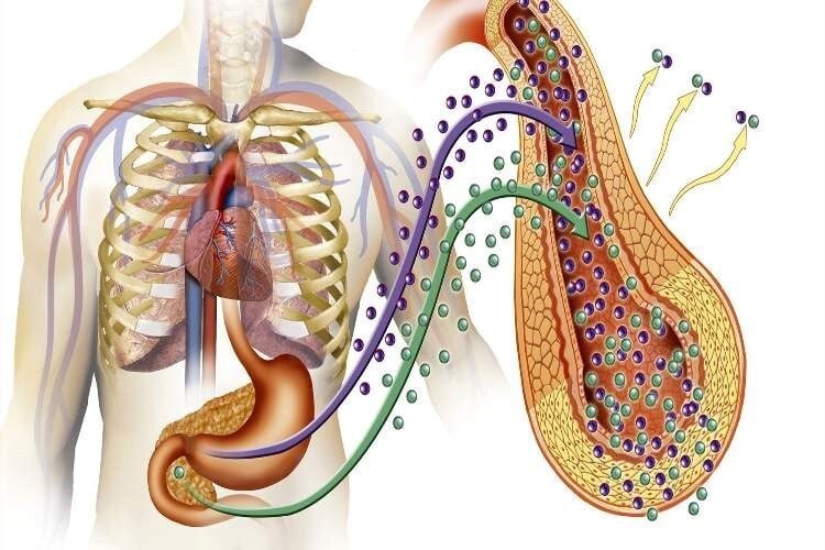 عمل لوزالمعده برای درمان دیابت در تهران