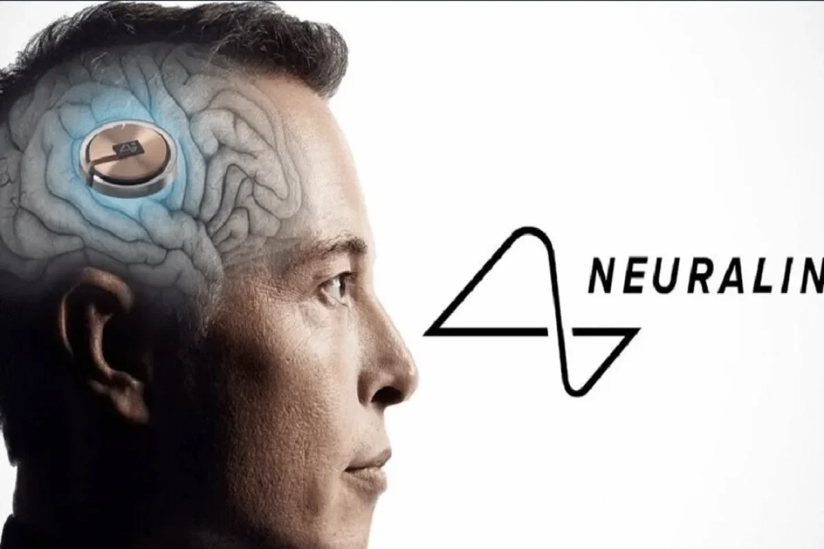 تولید انبوه ایمپلنت درمانی ایلان ماسک آغاز می‌شود