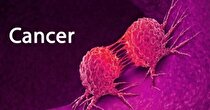 ۳۰ تا ۵۰ درصد سرطان‌ها قابل پیشگیری است