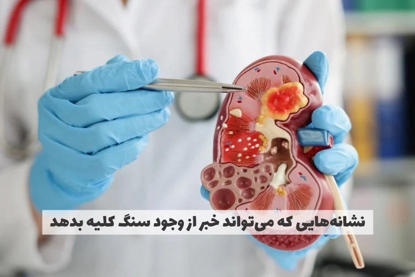 نشانههایی که میتواند خبر از وجود سنگ کلیه بدهد نشانههایی که میتواند خبر از وجود سنگ کلیه بدهد