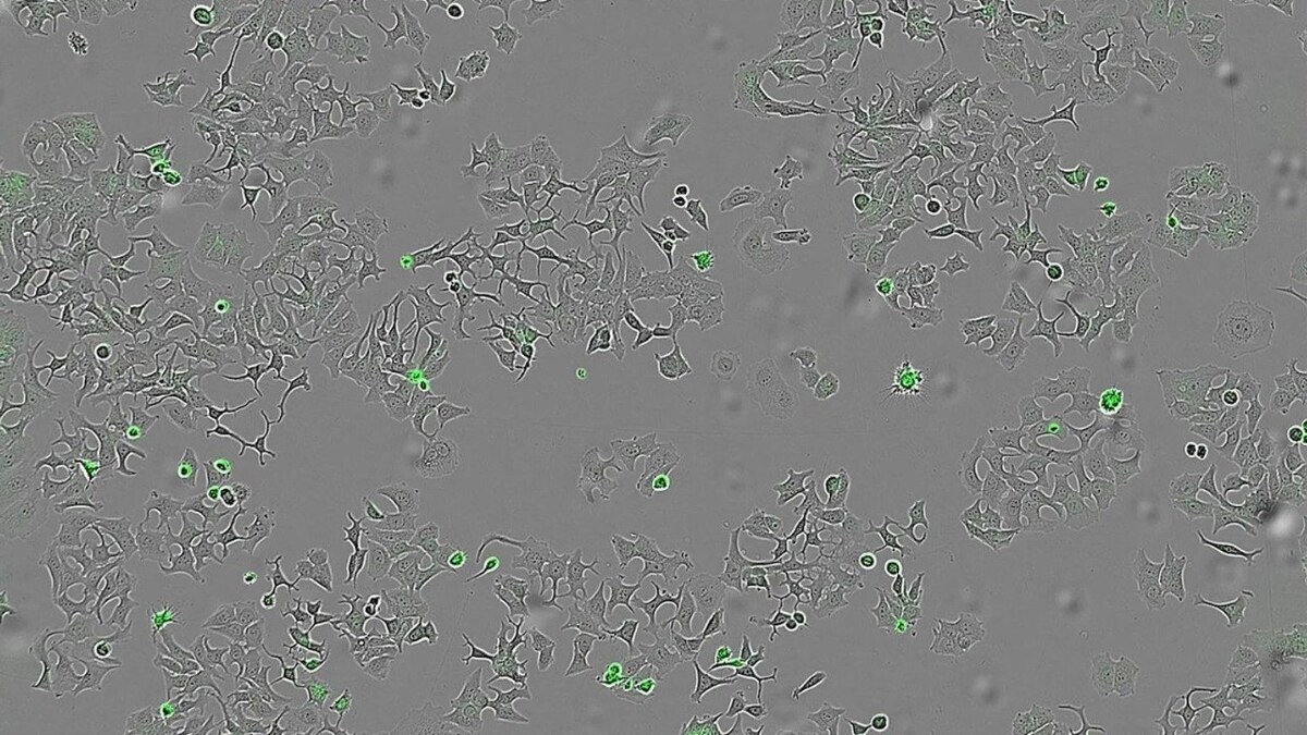 کشف امیدبخش دانشمندان اسپانیایی: پروتئینی که سلول‌های سرطانی را خودنابود می‌کند