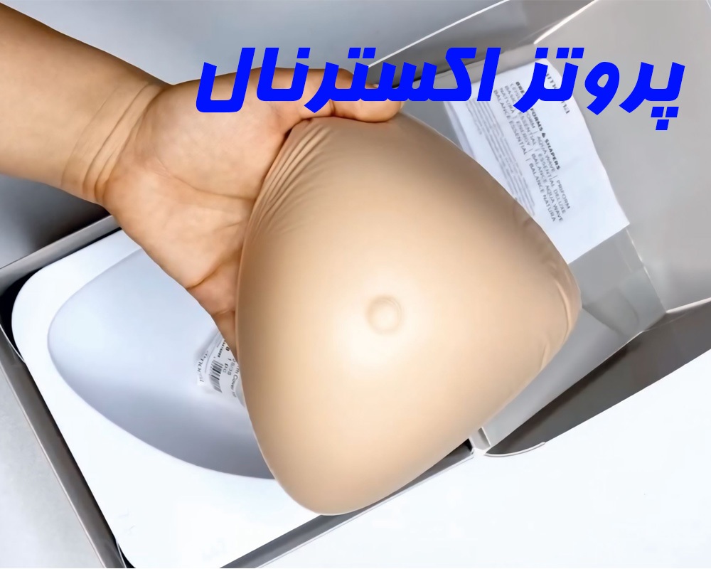 پروتز اکسترنال