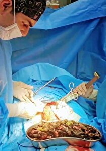 خروج ۹۰ بسته مواد مخدر از معده و روده یک بیمار در کرج