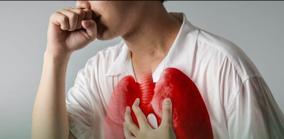 سرطان ریه و نقش مخرب سیگار در ۸۵ درصد موارد