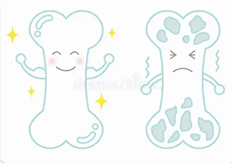 چگونه از کودکی از پوکی استخوان پیشگیری کنیم؟