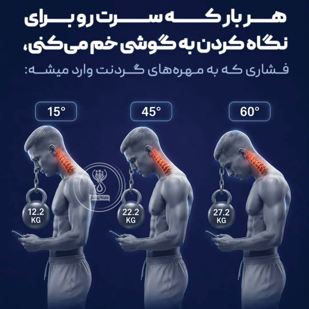 چرا بهتر است هنگام استفاده از تلفن همراه، سر خود را بیش از حد به سمت پایین خم نکنید؟ چرا بهتر است هنگام استفاده از تلفن همراه، سر خود را بیش از حد به سمت پایین خم نکنید؟