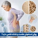 پوکی استخوان علامت و نشانه خاصی دارد؟
