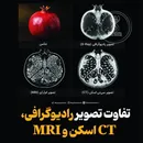 تفاوت تصویر رادیوگرافی، CT اسکن و MRI