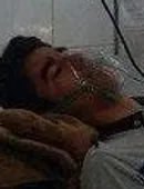 مسمومیت غذایی ۵ نفر از اهالی سوسن