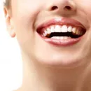 چطور لبخند جذاب تری داشته باشیم