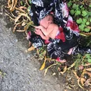 خورده شدن انگشتان یک نوزاد توسط موش‌ها