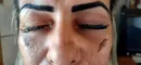 زنی که در جستجوی زیبایی بود خود را نابینا کرد