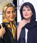 عکس چهره طناز طباطبایی قبل از جراحی زیبایی بینی!