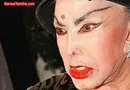 جزئیاتی از جراحی‌های عجیب در ایران