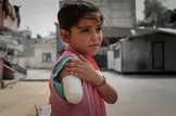رکوردشکنی غزه در قطعِ عضو کودکان