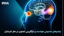 چشم‌های مصنوعی هوشمند و بازآفرینی تصاویر در مغز نابینایان